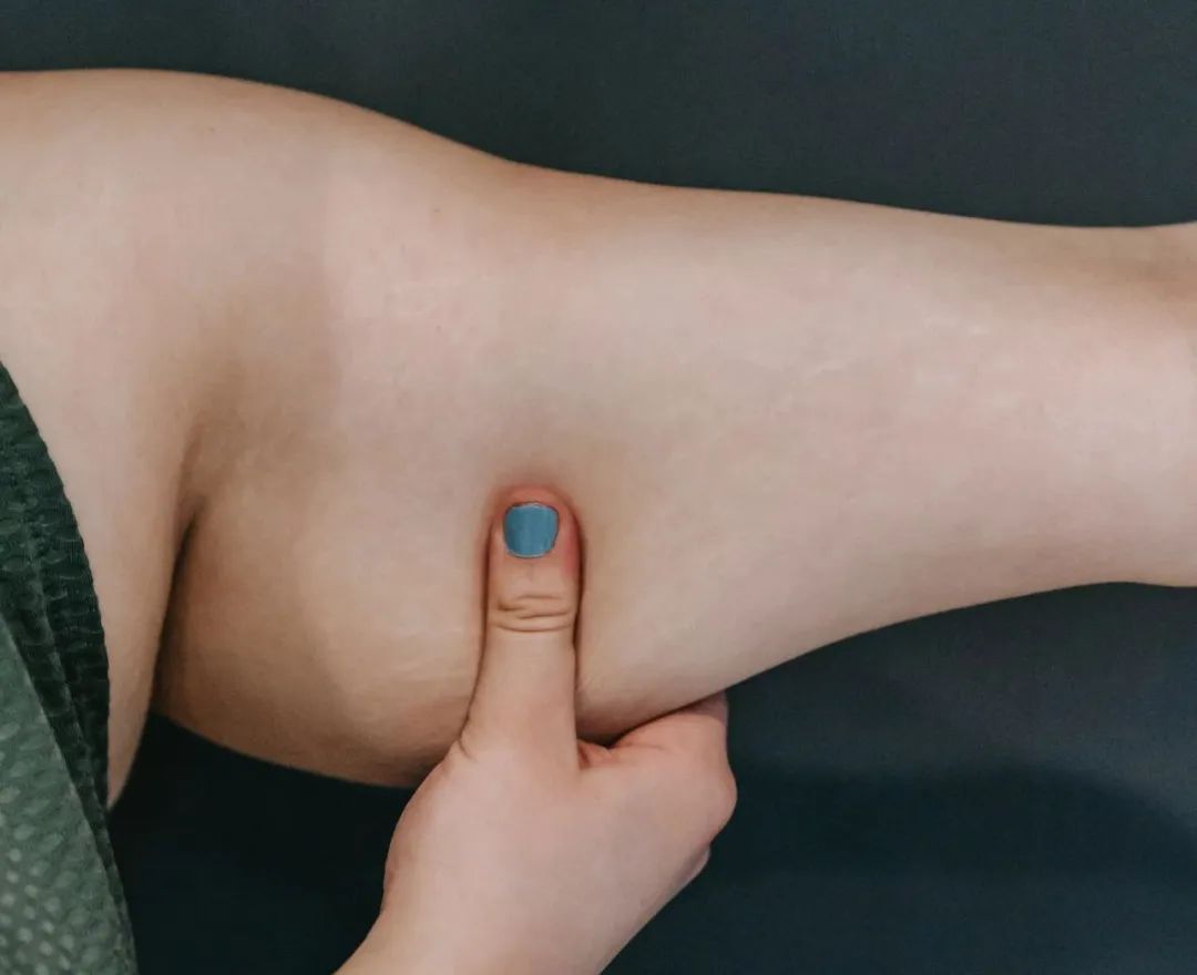 賽樂(lè )賽：不同肥胖類(lèi)型，應該怎么減肥